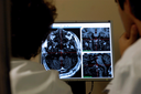 3D system helps patients with epilepsy
