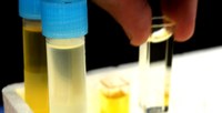 INESC TEC develops technology that monitors frying oils using optical systems and smartphones 