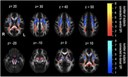 INESC TEC researcher publishes paper in NeuroImage